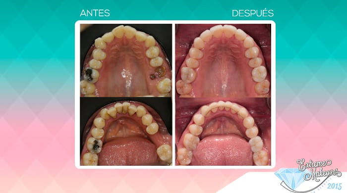 Galeria-dientes3